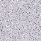 Immunohistochemical staining of human liver shows no positivity in hepatocytes as expected.