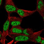 Immunofluorescent staining of human cell line SH-SY5Y shows localization to nucleoplasm.