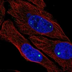Anti-ZDHHC4 Antibody