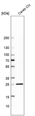 Anti-MBP Antibody