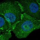 Immunofluorescent staining of human cell line HaCaT shows localization to plasma membrane.