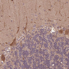 Anti-CUTA Antibody