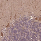 Anti-CUTA Antibody