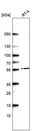 Western blot analysis in human cell line RT-4.