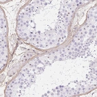 Anti-PDZD2 Antibody