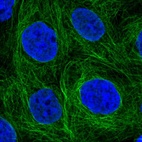 Immunofluorescent staining of human cell line A-431 shows localization to nucleoplasm & microtubules.