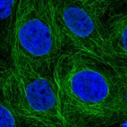 Immunofluorescent staining of human cell line A-431 shows localization to nucleoplasm & microtubules.