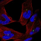 Anti-CEP290 Antibody