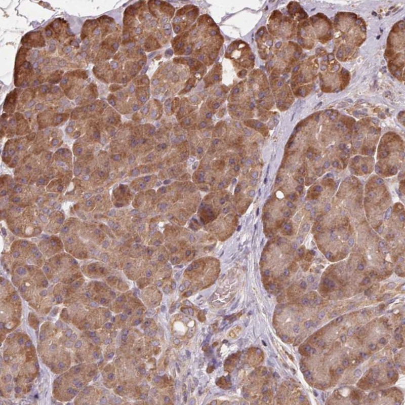 Anti-MAP3K5 Antibody