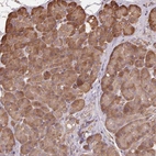 Anti-MAP3K5 Antibody