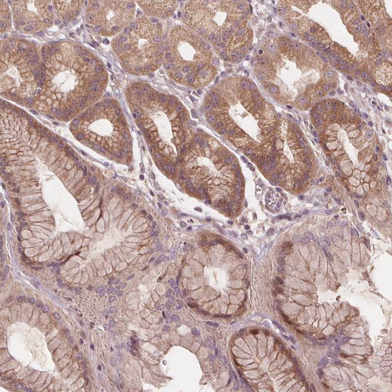 Anti-AKT1S1 Antibody