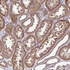Immunohistochemical staining of human kidney shows moderate granular cytoplasmic positivity in cells in tubules.