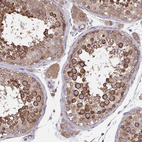 Immunohistochemical staining of human testis shows moderate membranous positivity in cells in seminiferous ducts.
