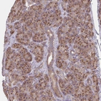 Immunohistochemical staining of human pancreas shows moderate granular cytoplasmic positivity in exocrine glandular cells.