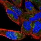 Immunofluorescent staining of human cell line RH-30 shows localization to cytosol & the Golgi apparatus.