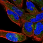 Immunofluorescent staining of human cell line RH-30 shows localization to cytosol & the Golgi apparatus.