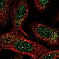 Anti-NDUFB4 Antibody