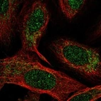 Anti-NDUFB4 Antibody