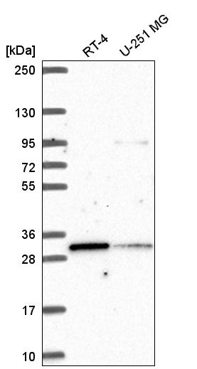 Anti-MLX Antibody