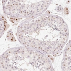 Anti-ARHGAP22 Antibody