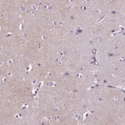 Immunohistochemical staining of human cerebral cortex shows high expression.
