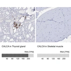 Anti-CALCA Antibody