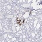 Immunohistochemical staining of human thyroid gland shows strong cytoplasmic positivity in a subset of glandular cells.