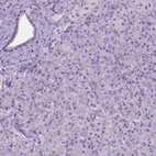 Immunohistochemical staining of human pancreas shows low expression as expected.