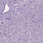 Immunohistochemical staining of human pancreas shows low expression as expected.