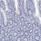 Immunohistochemical staining of human gastrointestinal shows no positivity in glandular cells.