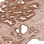 Immunohistochemical staining of human prostate shows strong cytoplasmic positivity in glandular cells.