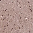 Immunohistochemical staining of human cerebral cortex shows moderate cytoplasmic positivity in neurons.