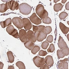 Immunohistochemical staining of human skeletal muscle shows moderate cytoplasmic positivity in myocytes.
