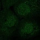 Immunofluorescent staining of human cell line A-431 shows localization to nucleus & cytosol.