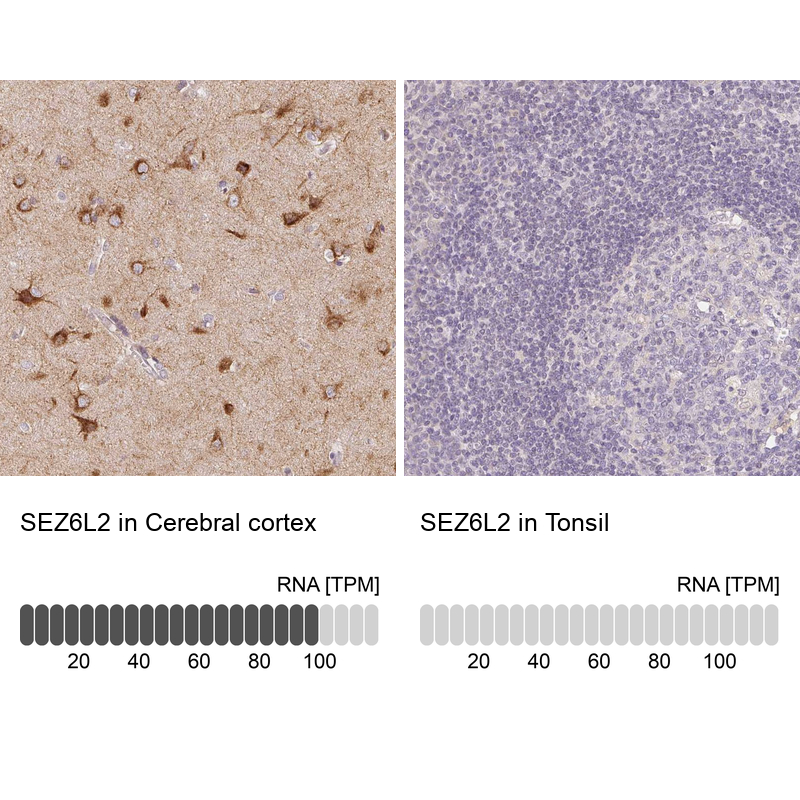Anti-SEZ6L2 Antibody
