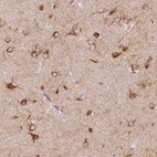Immunohistochemical staining of human cerebral cortex shows high expression.