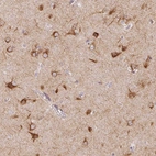 Immunohistochemical staining of human cerebral cortex shows high expression.