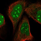 Immunofluorescent staining of human cell line U-2 OS shows localization to nucleus & nucleoli.