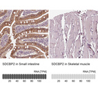Anti-SDCBP2 Antibody