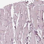 Immunohistochemical staining of human skeletal muscle shows low expression as expected.