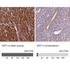 Anti-GOT1 Antibody