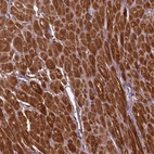 Immunohistochemical staining of human heart muscle shows strong cytoplasmic positivity in cardiomyocytes.