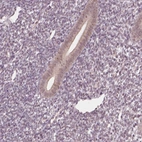 Immunohistochemical staining of human endometrium shows weak cytoplasmic positivity in glandular cells.