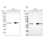 Western blot analysis using Anti-GOT1 antibody HPA064532 (A) shows similar pattern to independent antibody HPA072629 (B).