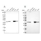 Western blot analysis using Anti-GOT1 antibody HPA064532 (A) shows similar pattern to independent antibody HPA072629 (B).