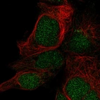 Anti-LYSMD1 Antibody