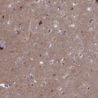 Immunohistochemical staining of human cerebral cortex shows high expression.