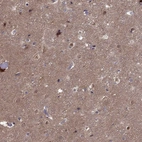Immunohistochemical staining of human cerebral cortex shows high expression.