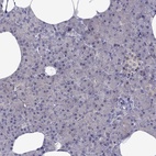 Anti-CDK5 Antibody