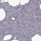 Immunohistochemical staining of human pancreas shows low expression as expected.